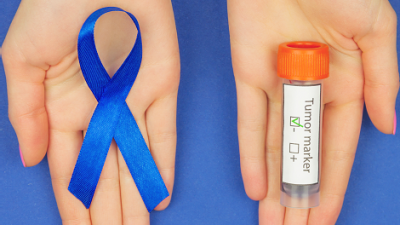 Testtube und blaue Schleife