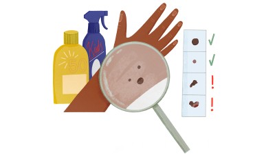 Illustration Sonnenschutz